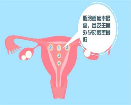 成都专业代怀孕机构_成都代孕中心官方网站_成都